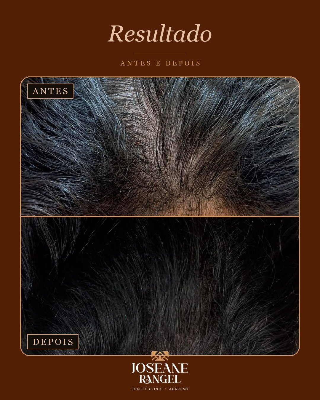 Evolução capilar, antes e depois